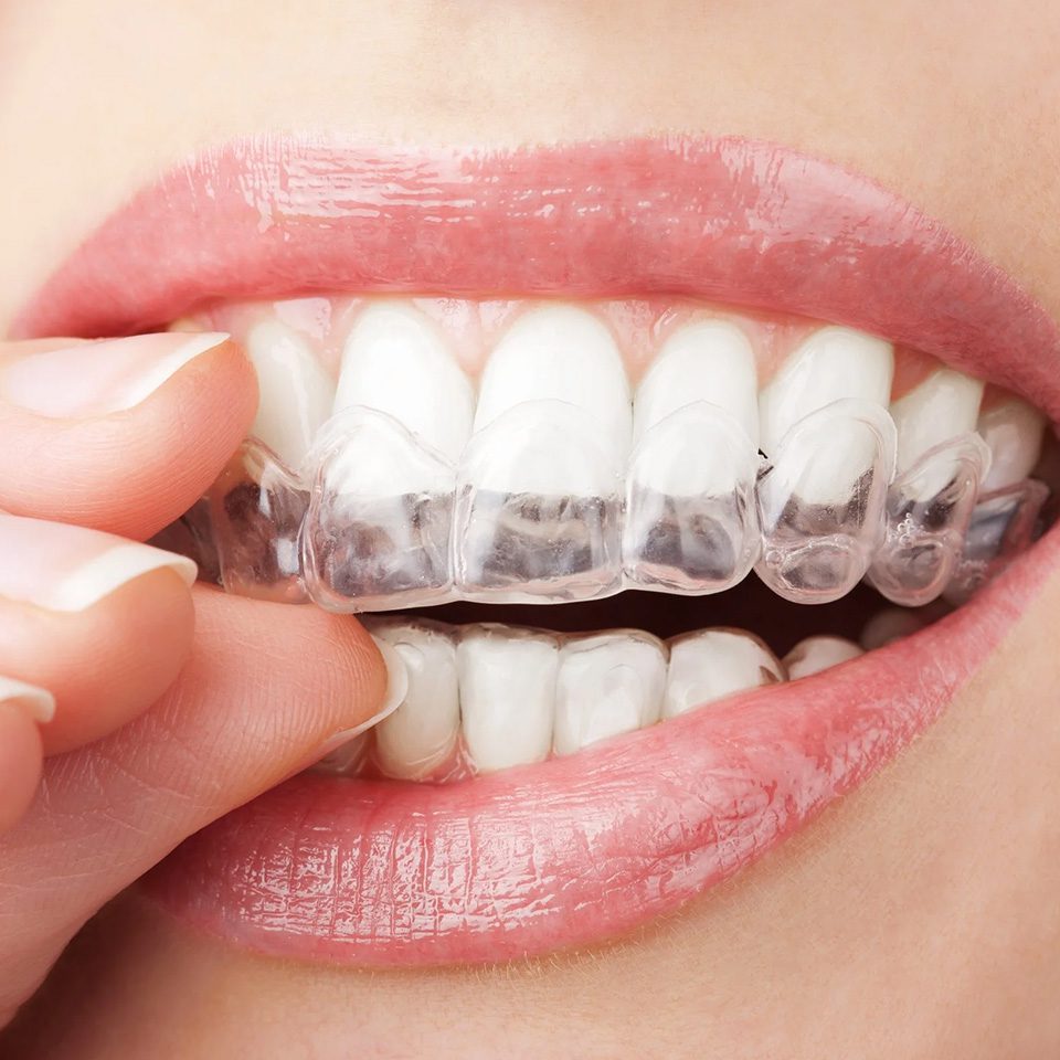 Espacialidad Ortodoncia